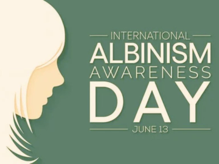 International Albinism Awareness Day 2024