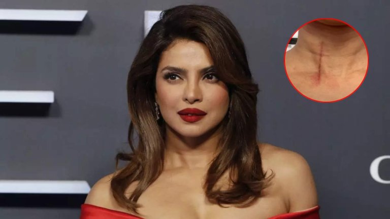 Priyanka Chopra injured during the bluff shooting actress shared photo of neck wound on Instagram