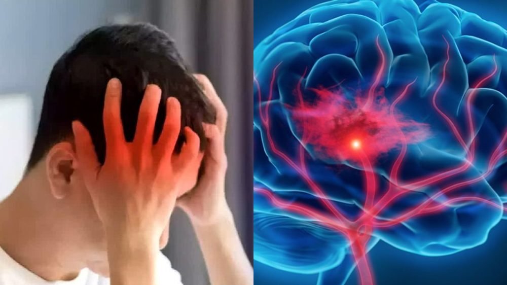 brain stroke kya hota hai